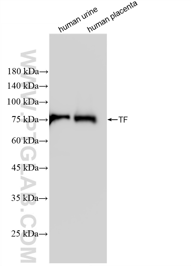 Transferrin/TF