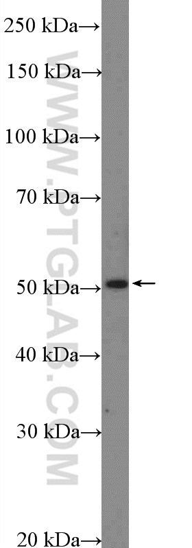 Western Blot (WB) analysis of HeLa cells using TFAP2D Polyclonal antibody (18835-1-AP)