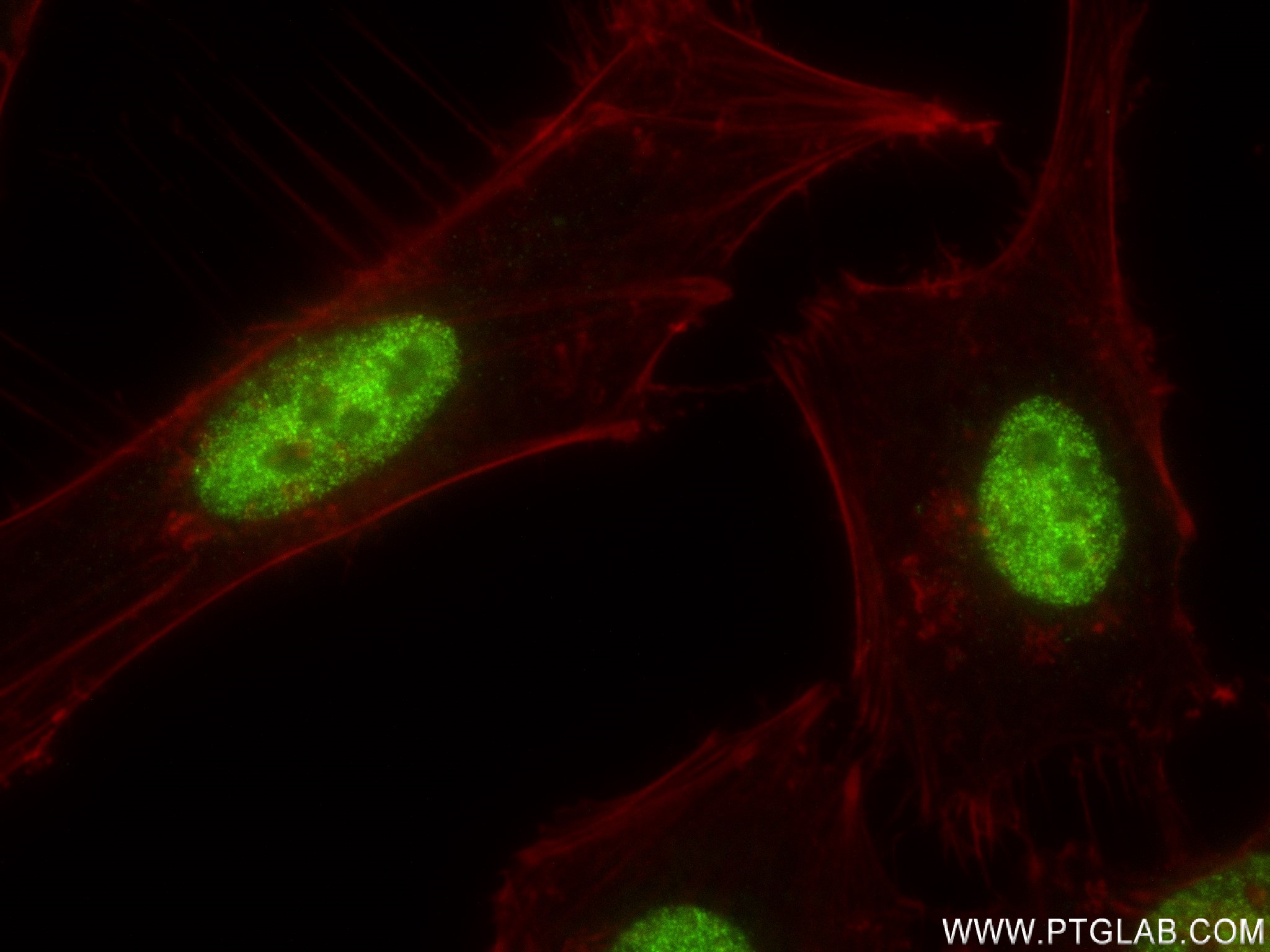 Immunofluorescence (IF) / fluorescent staining of HeLa cells using TFAP4 Recombinant antibody (83196-4-RR)