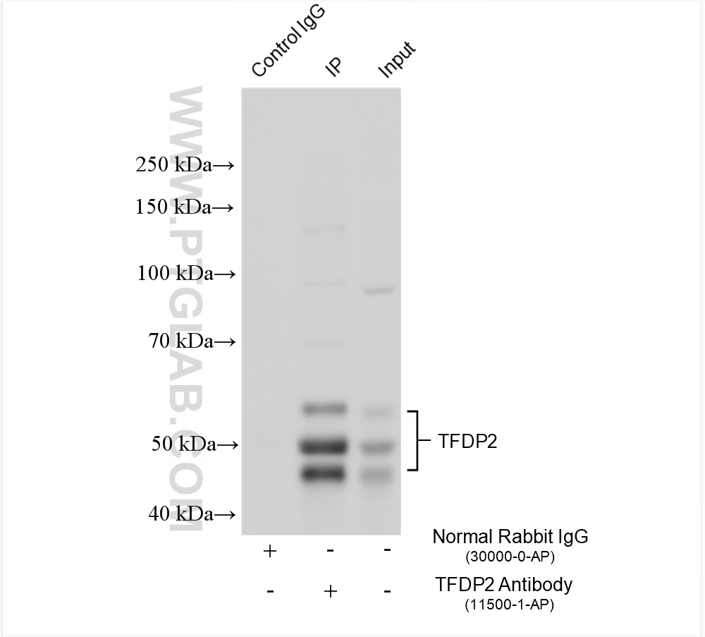 Immunoprecipitation (IP) experiment of SH-SY5Y cells using TFDP2 Polyclonal antibody (11500-1-AP)