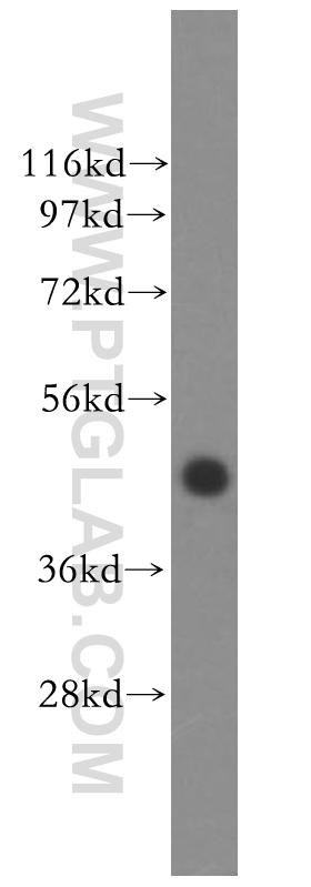 Western Blot (WB) analysis of human brain tissue using TFDP2 Polyclonal antibody (11500-1-AP)