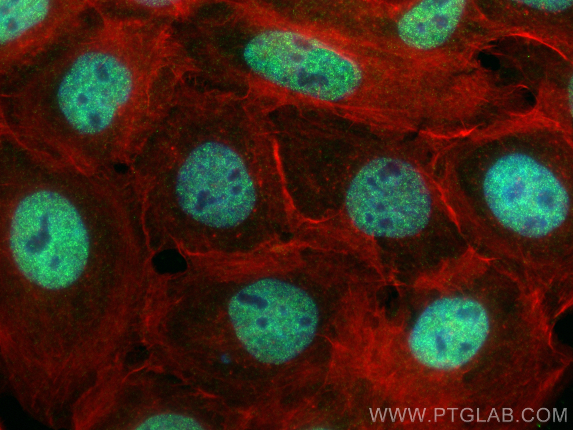 Immunofluorescence (IF) / fluorescent staining of A431 cells using TFDP2 Recombinant antibody (84408-4-RR)