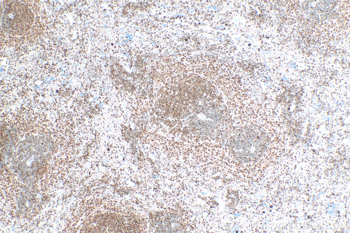 Immunohistochemistry (IHC) staining of rat spleen tissue using TFEB Polyclonal antibody (13372-1-AP)