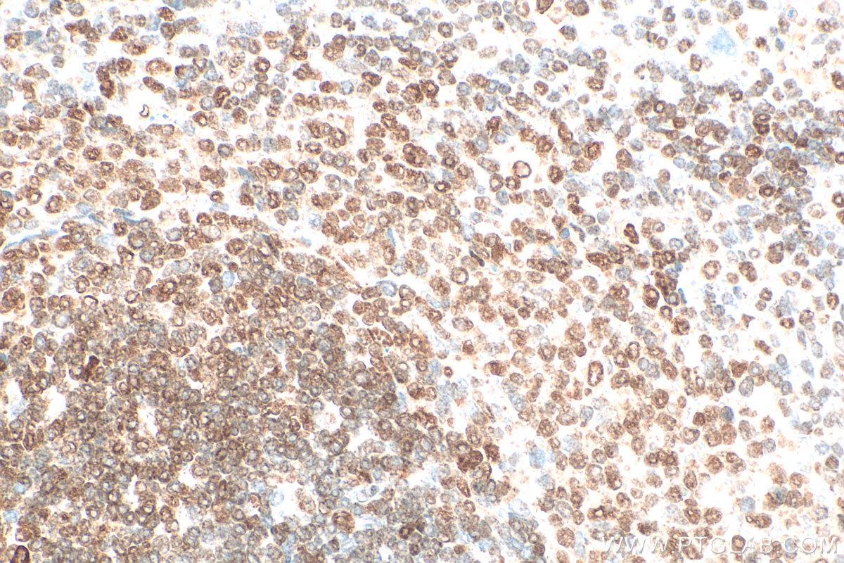Immunohistochemistry (IHC) staining of rat spleen tissue using TFEB Polyclonal antibody (13372-1-AP)