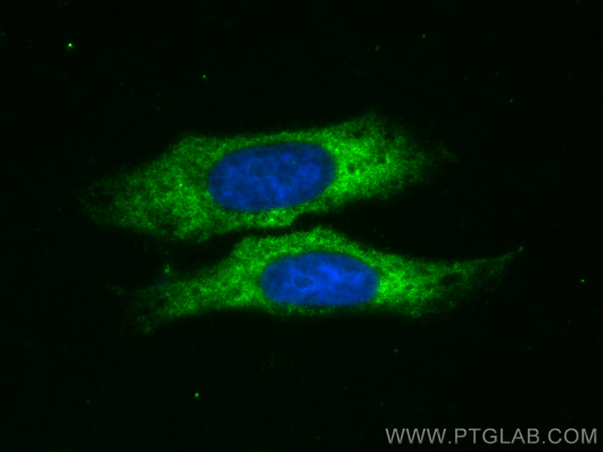 Immunofluorescence (IF) / fluorescent staining of HepG2 cells using CoraLite® Plus 488-conjugated TFEB Polyclonal anti (CL488-13372)