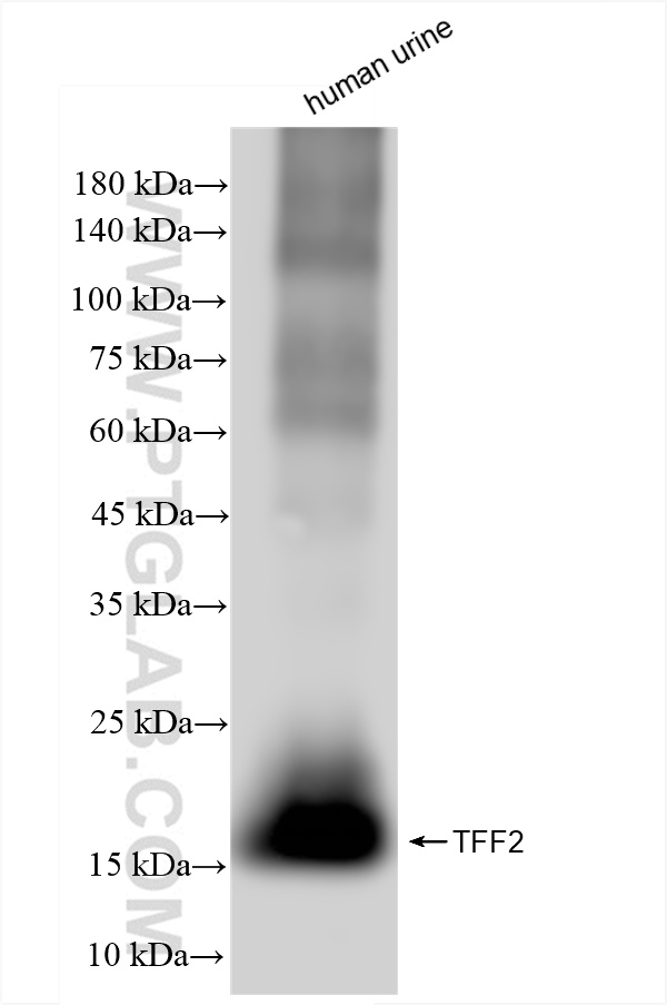 Western Blot (WB) analysis of human urine sample using TFF2 Recombinant antibody (83717-4-RR)