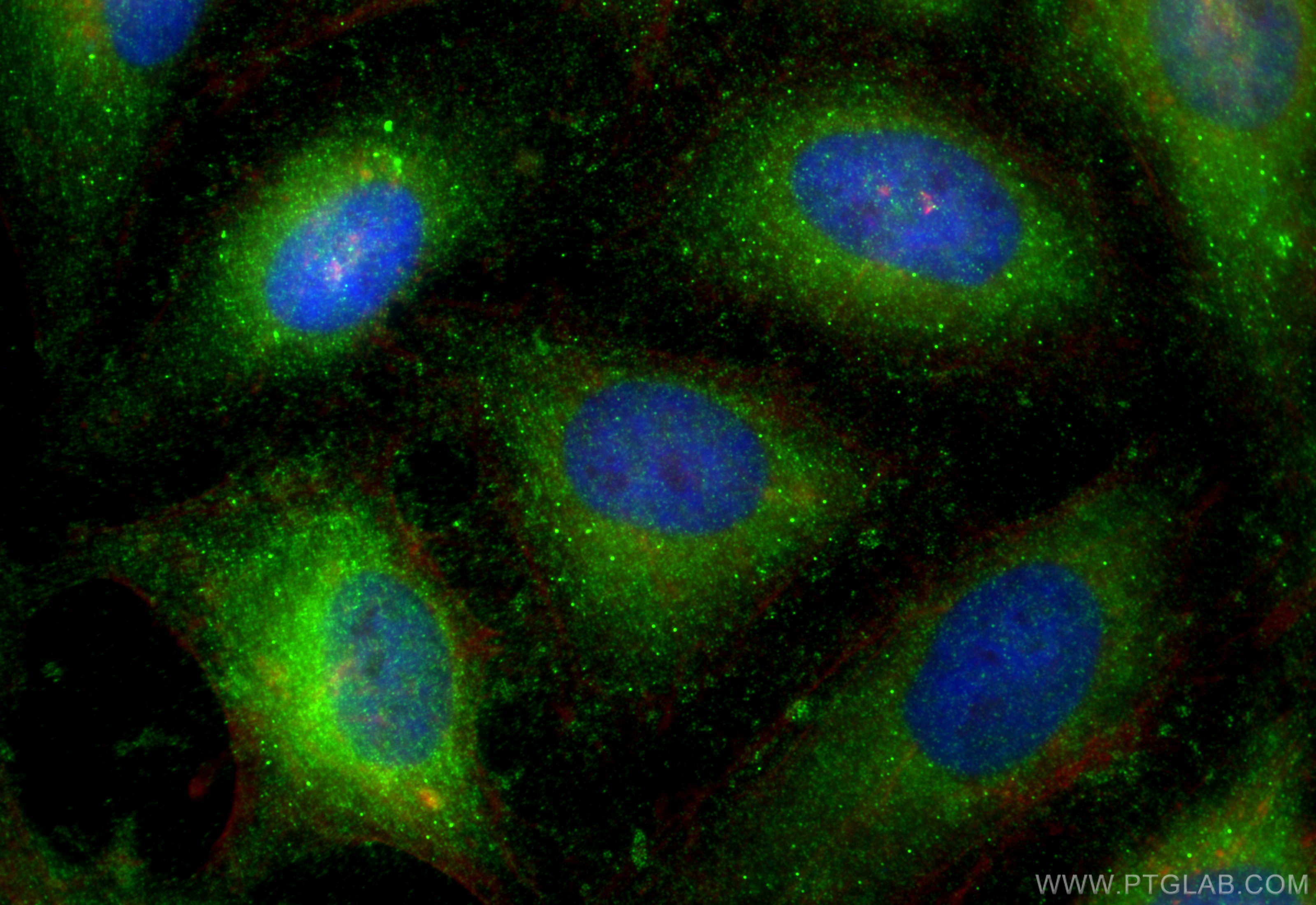 Immunofluorescence (IF) / fluorescent staining of HeLa cells using TFPI Polyclonal antibody (31765-1-AP)