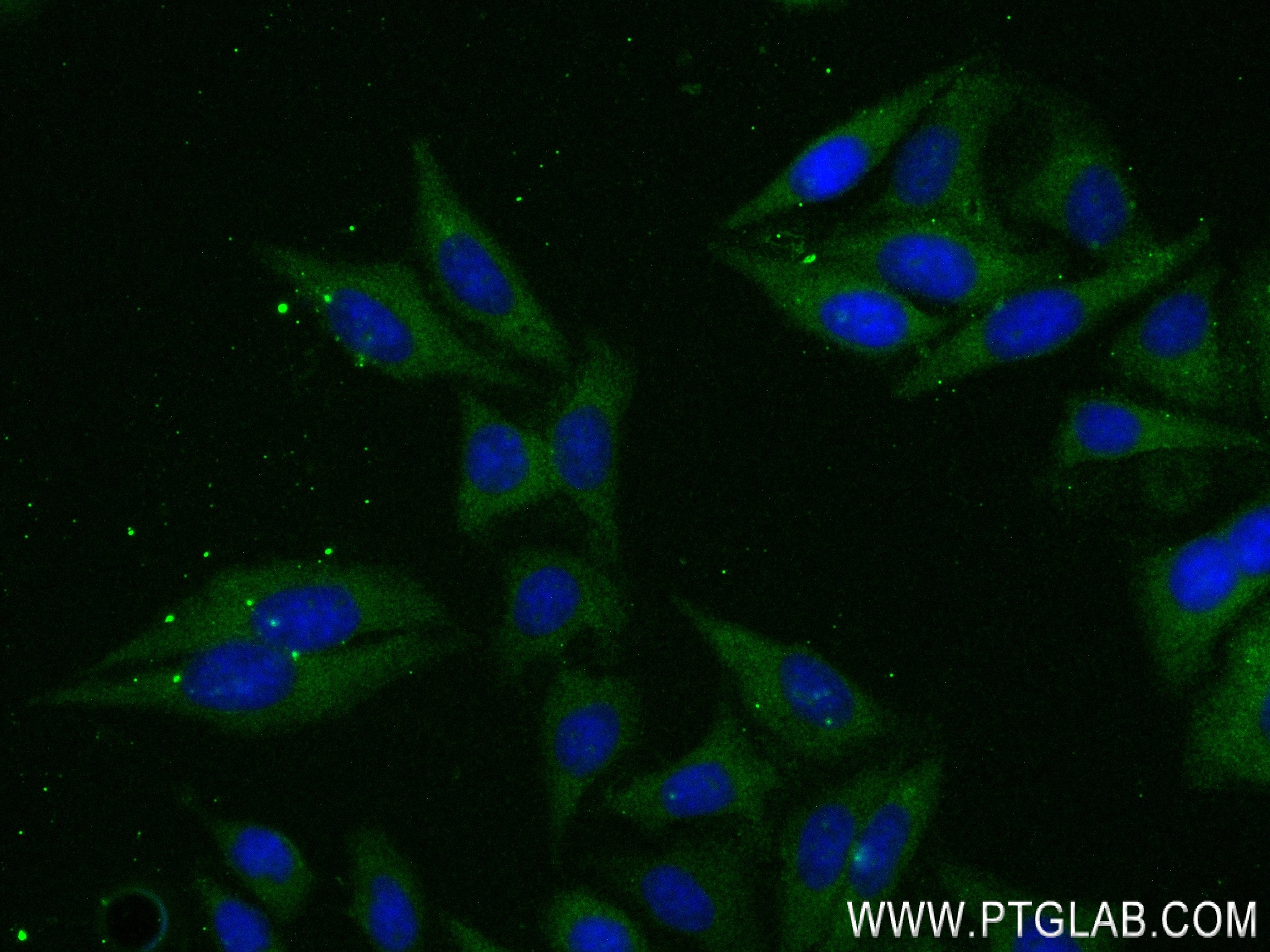 Immunofluorescence (IF) / fluorescent staining of HepG2 cells using TFPI Recombinant antibody (83838-5-RR)