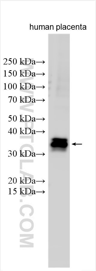 Western Blot (WB) analysis of various lysates using TFPI2 Polyclonal antibody (30689-1-AP)