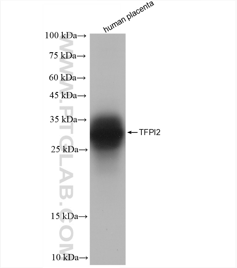 Western Blot (WB) analysis of human placenta tissue using TFPI2 Recombinant antibody (83279-1-RR)