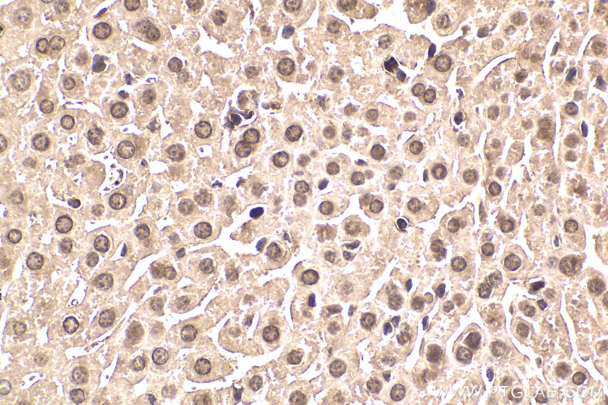 Immunohistochemistry (IHC) staining of mouse liver tissue using TFPT Polyclonal antibody (10097-2-AP)