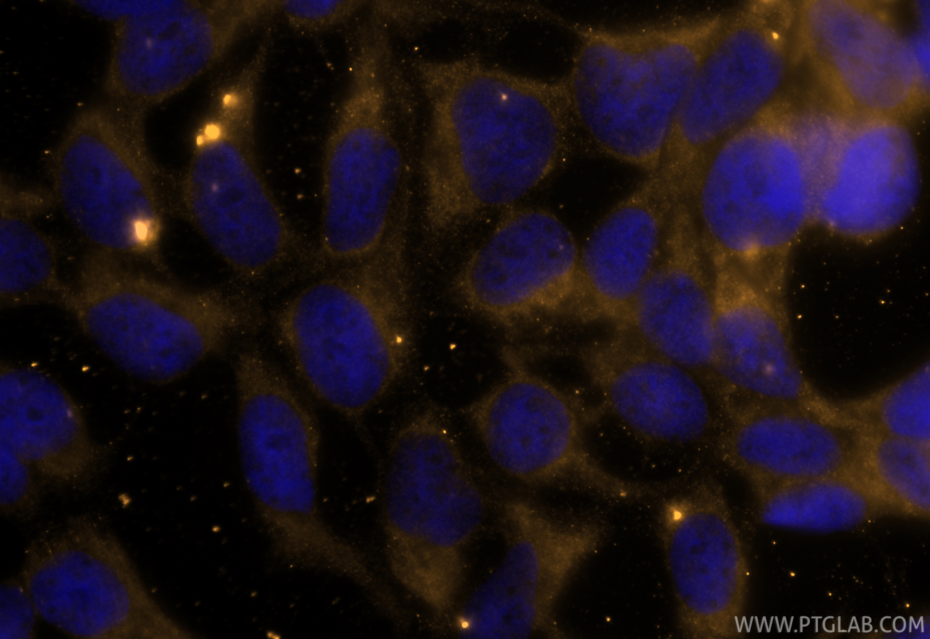 Immunofluorescence (IF) / fluorescent staining of HEK-293 cells using CoraLite® Plus 555-conjugated TGF Beta 1 Recombina (CL555-81746-2)