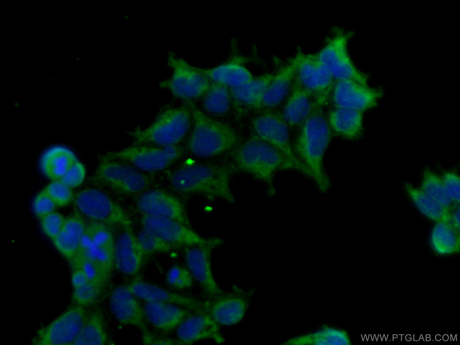 TGF-beta 1 Antibody 21898-1-AP | Proteintech