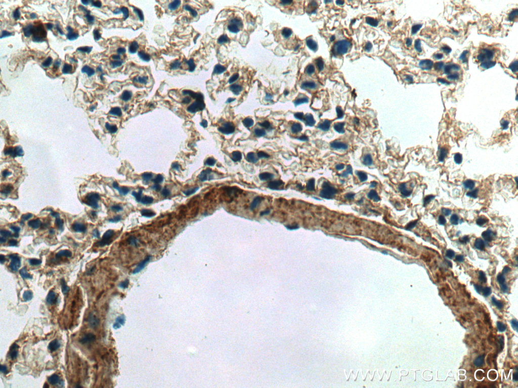 TGF Beta 1 Antibody (21898-1-AP) | Proteintech