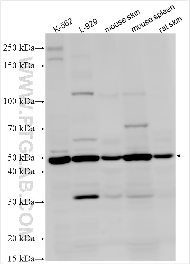 Western Blot (WB) analysis of various lysates using TGF Beta 1 Polyclonal antibody (21898-1-AP)