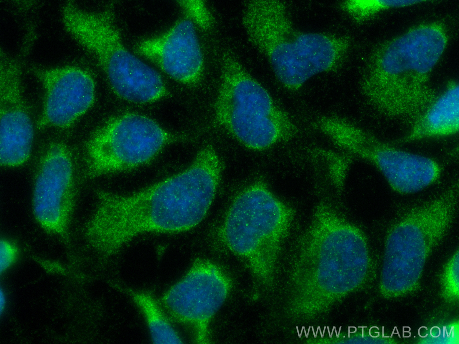 Immunofluorescence (IF) / fluorescent staining of HEK-293 cells using TGF Beta 1 Recombinant antibody (81746-2-RR)