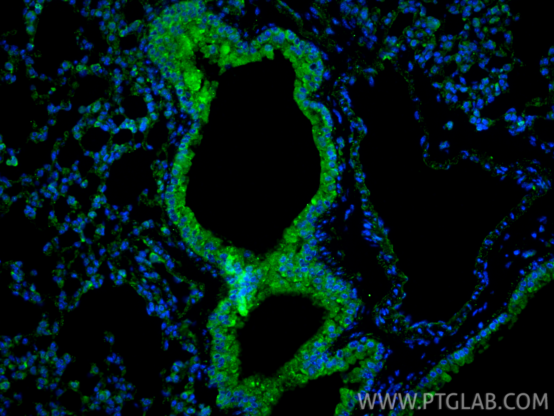 Immunofluorescence (IF) / fluorescent staining of mouse lung tissue using TGF Beta 1 Recombinant monoclonal antibody (81746-2-RR)