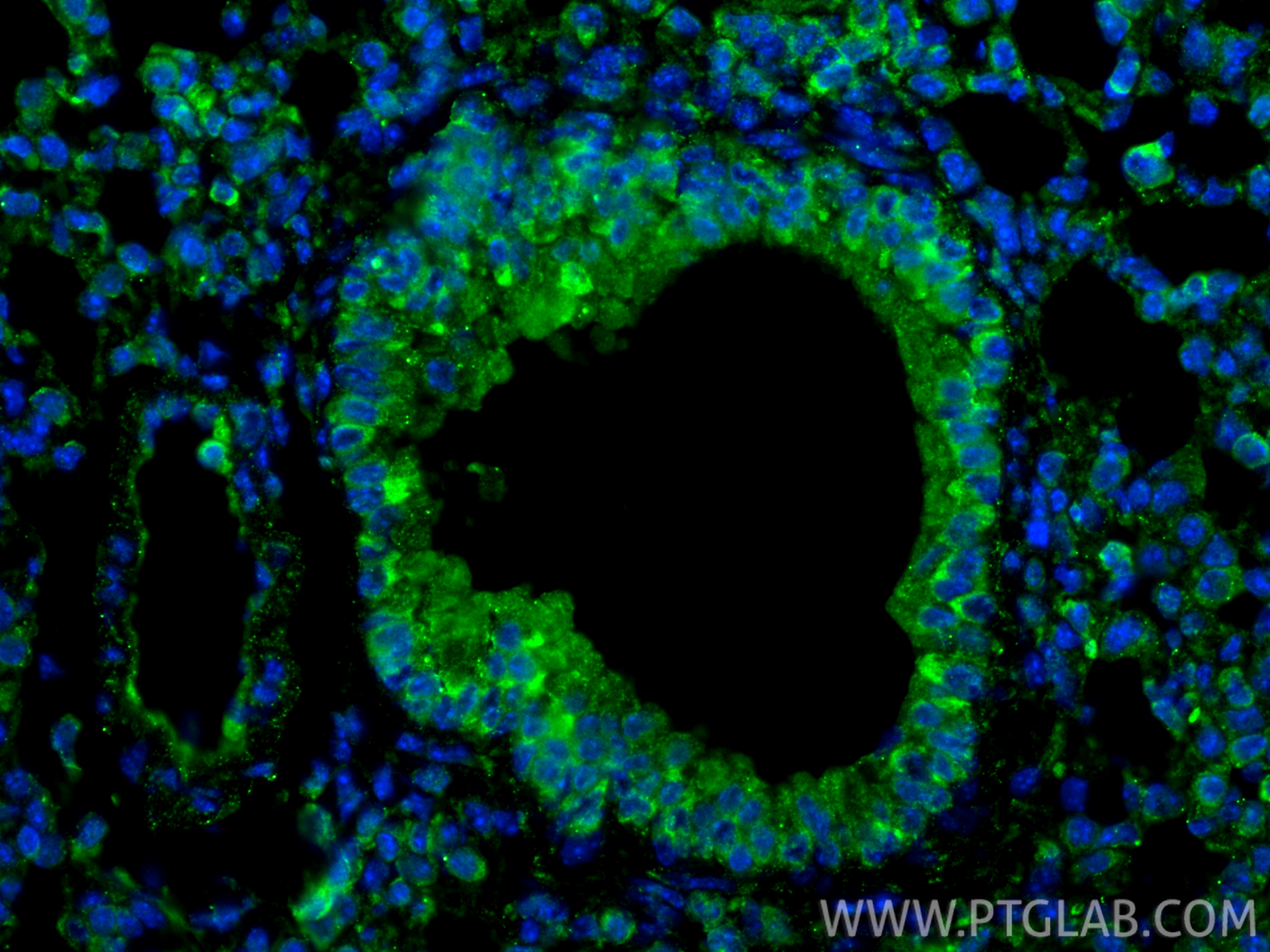 Immunofluorescence (IF) / fluorescent staining of mouse lung tissue using TGF Beta 1 Recombinant monoclonal antibody (81746-2-RR)