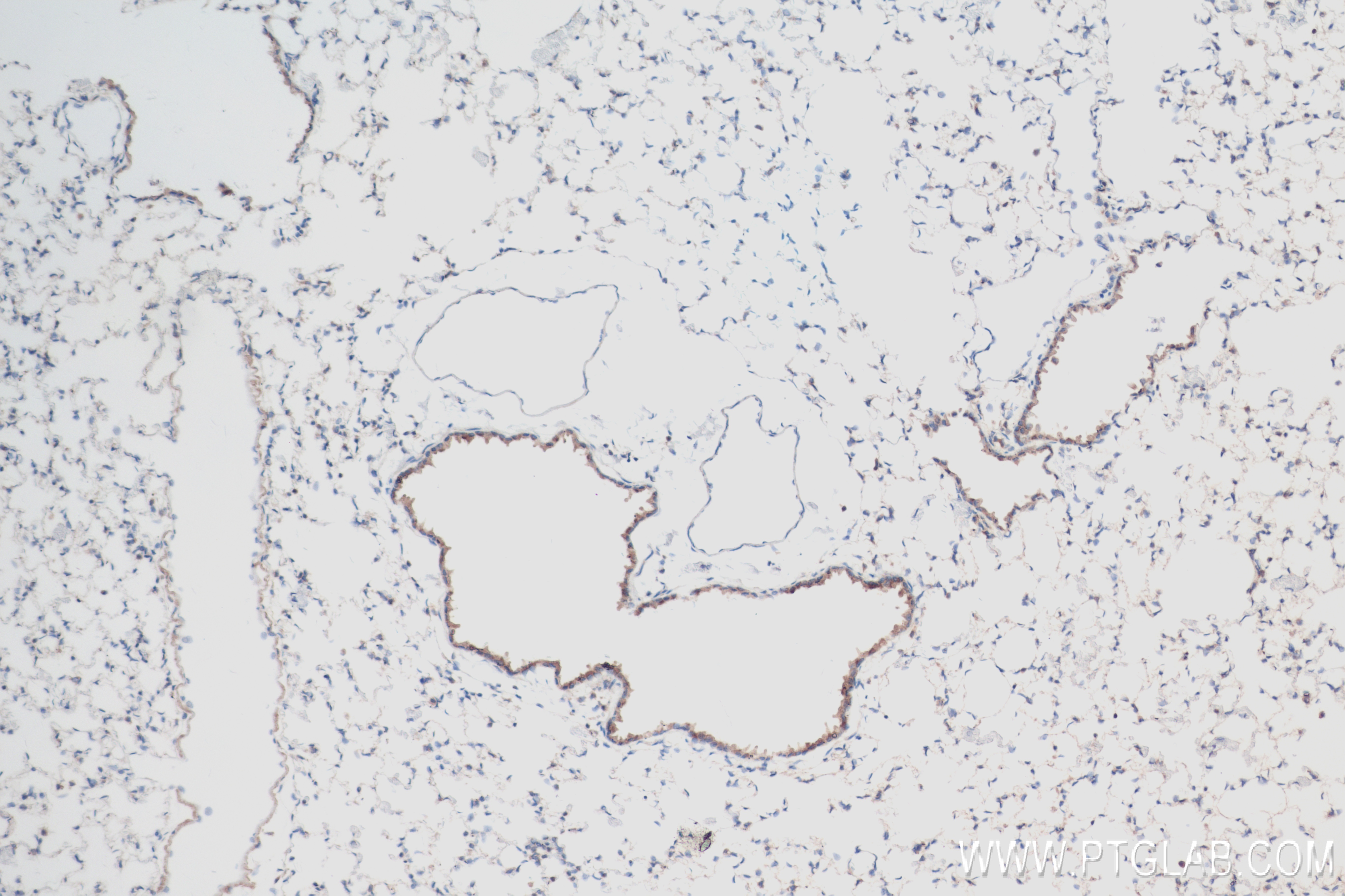 Immunohistochemistry (IHC) staining of mouse lung tissue using TGF Beta 1 Recombinant antibody (81746-2-RR)