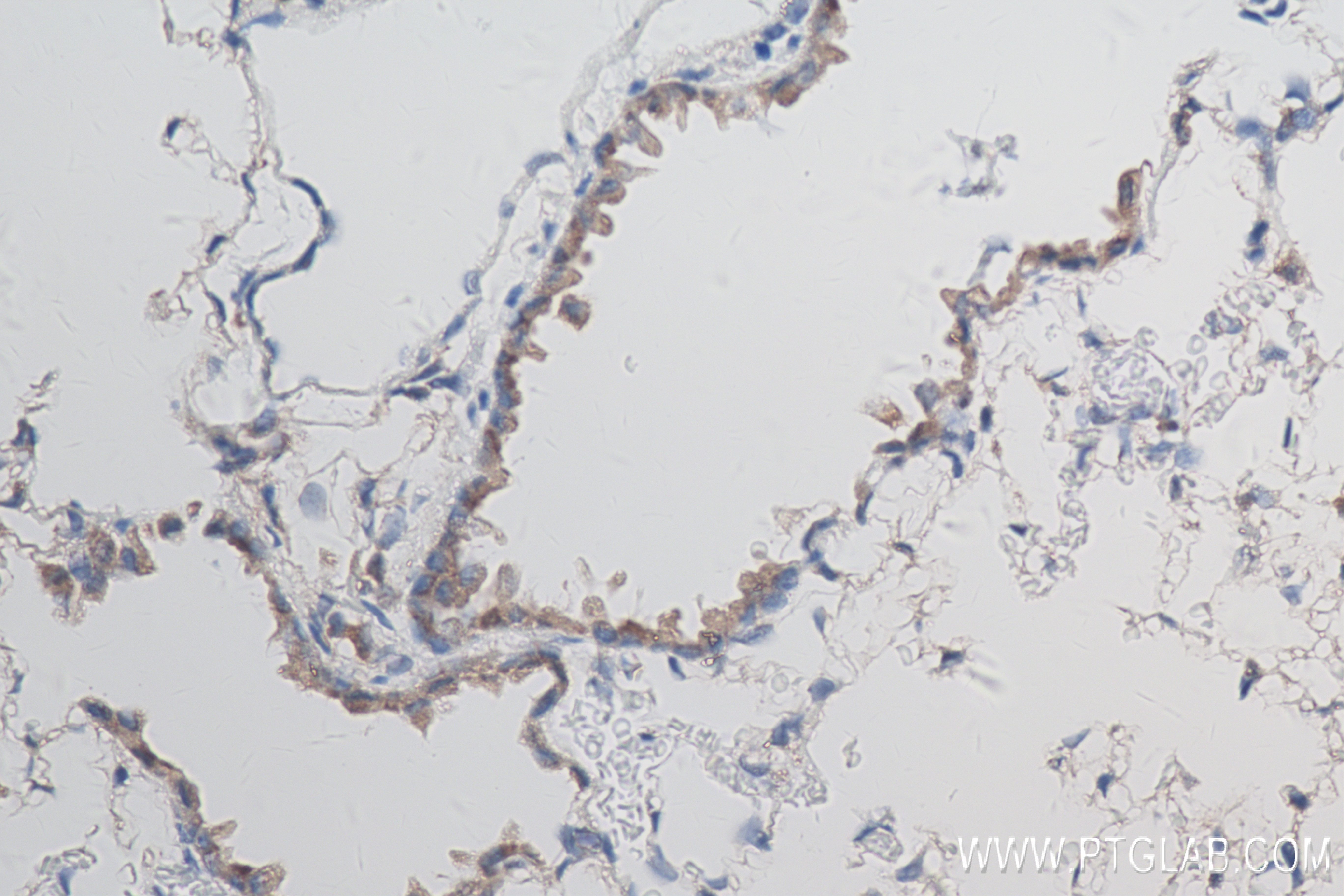 Immunohistochemistry (IHC) staining of mouse lung tissue using TGF Beta 1 Recombinant antibody (81746-2-RR)