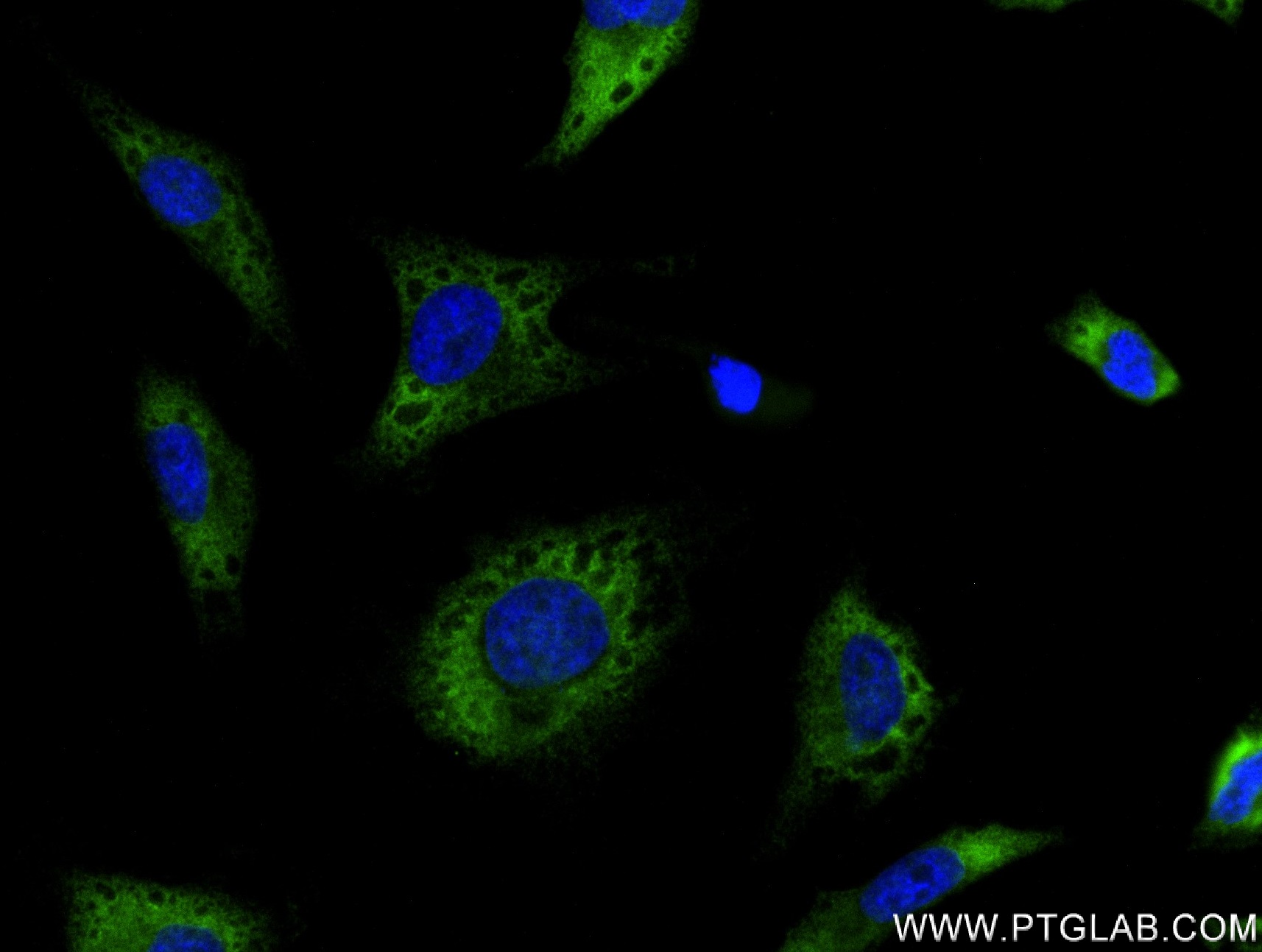 Immunofluorescence (IF) / fluorescent staining of HeLa cells using TGFB2-Specific Recombinant antibody (83167-5-RR)