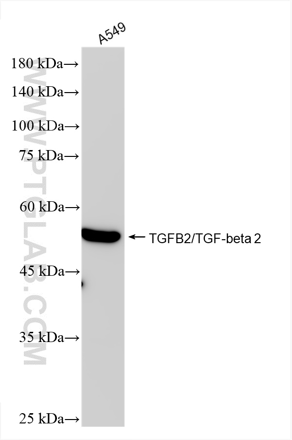 Western Blot (WB) analysis of various lysates using TGFB2/TGF-beta 2 Recombinant antibody (83167-5-RR)