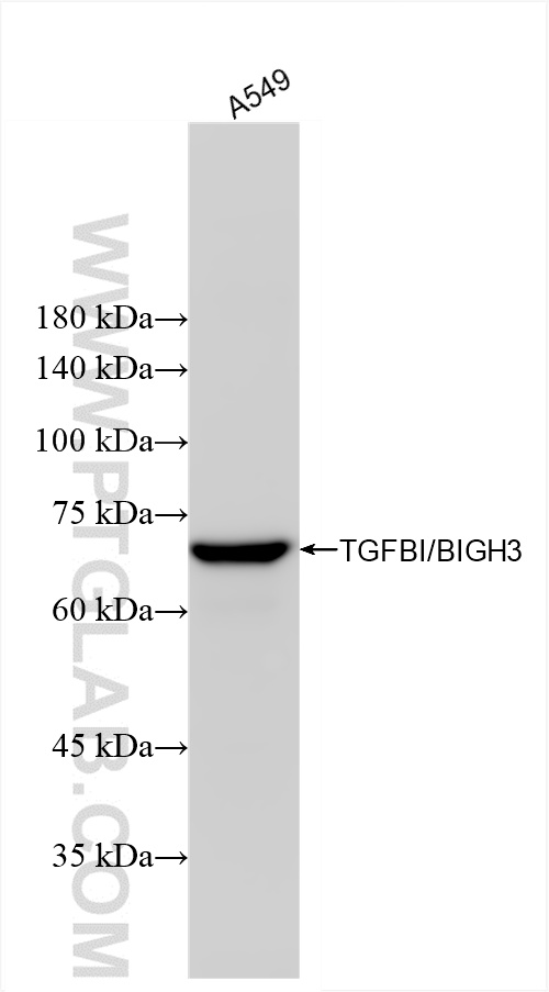 Western Blot (WB) analysis of A549 cells using TGFBI/BIGH3 Recombinant antibody (80805-4-RR)