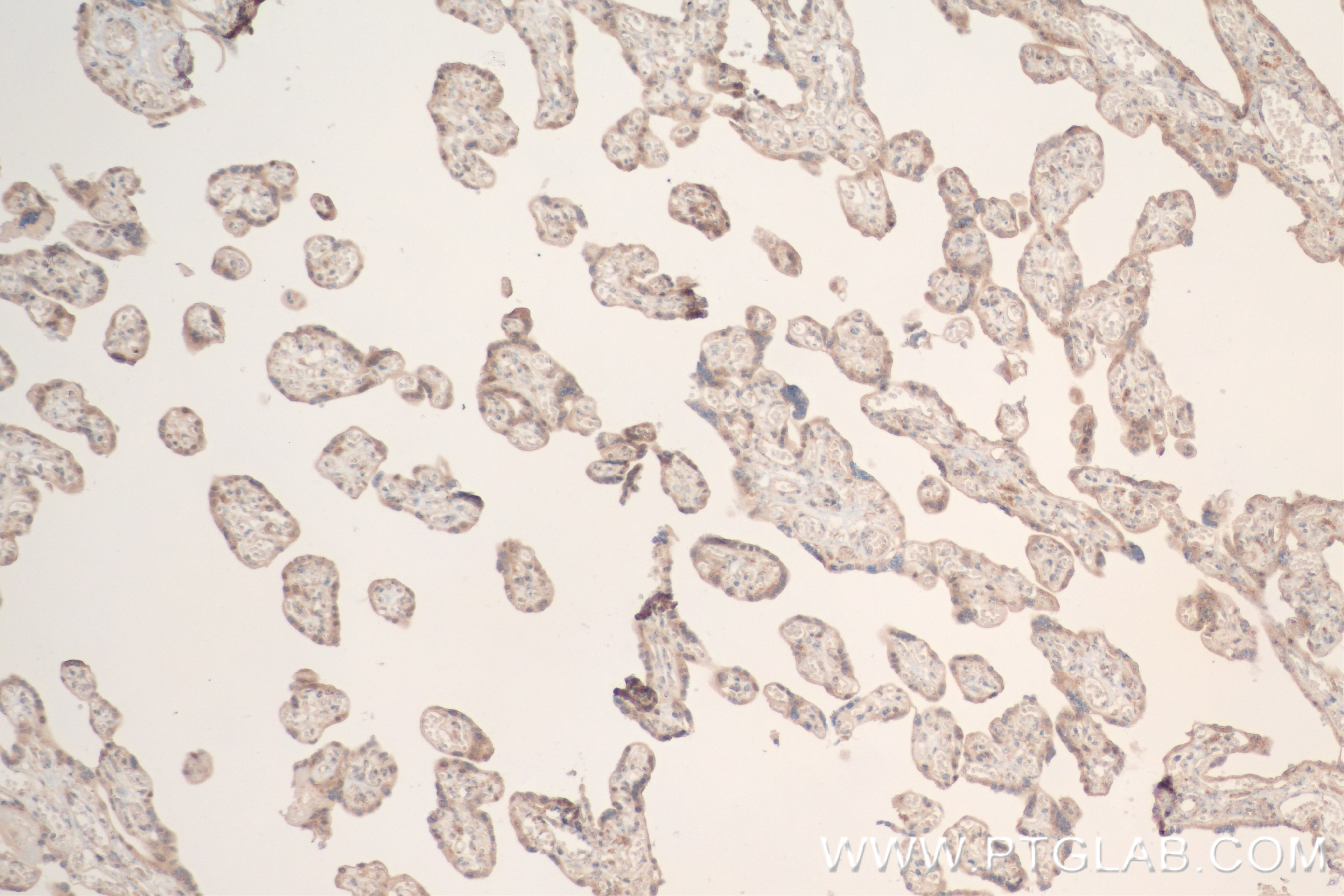 Immunohistochemistry (IHC) staining of human placenta tissue using TGFBR1 Recombinant antibody (84453-1-RR)