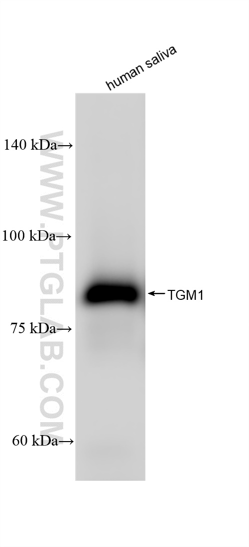 Western Blot (WB) analysis of various lysates using TGM1 Recombinant antibody (84032-2-RR)