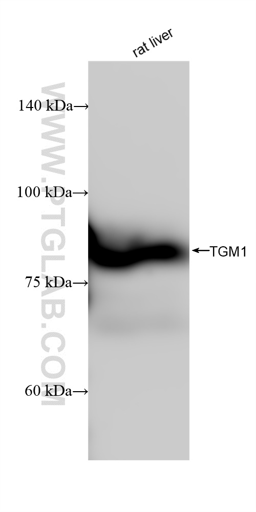 TGM1