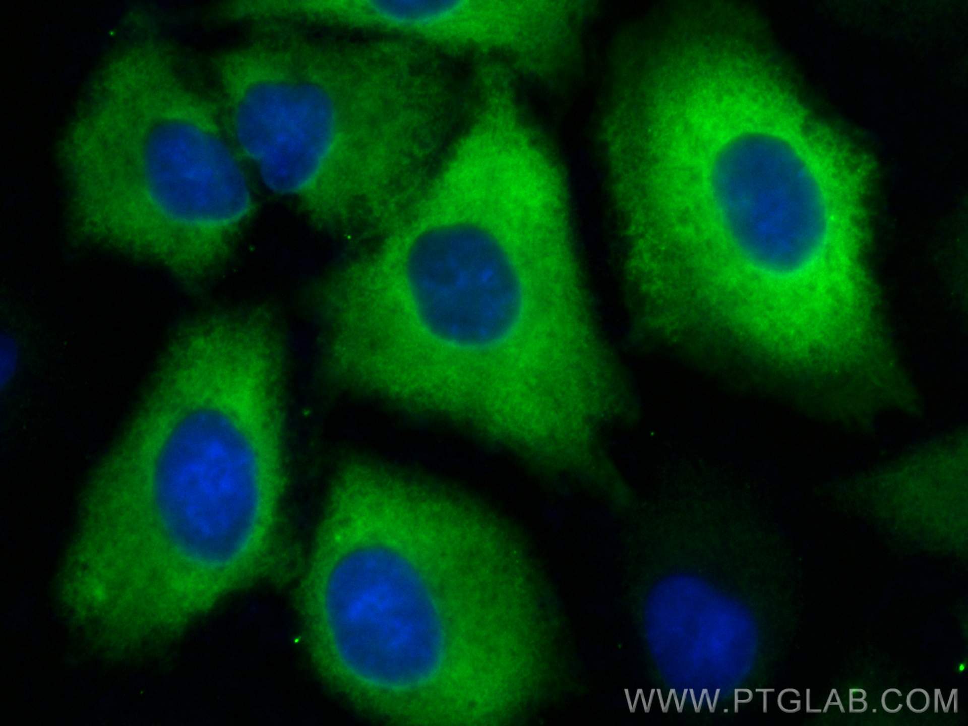 Immunofluorescence (IF) / fluorescent staining of A549 cells using TGM2 Monoclonal antibody (68006-1-Ig)