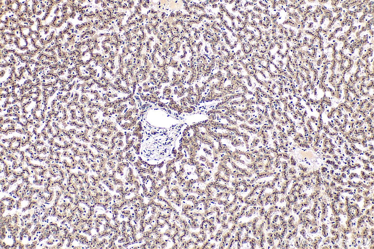 Immunohistochemistry (IHC) staining of human liver tissue using TGN46 Polyclonal antibody (13573-1-AP)