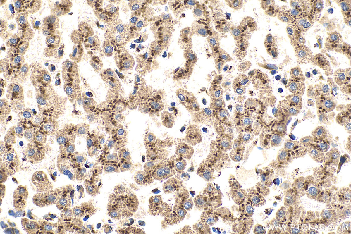 Immunohistochemistry (IHC) staining of human liver tissue using TGN46 Polyclonal antibody (13573-1-AP)