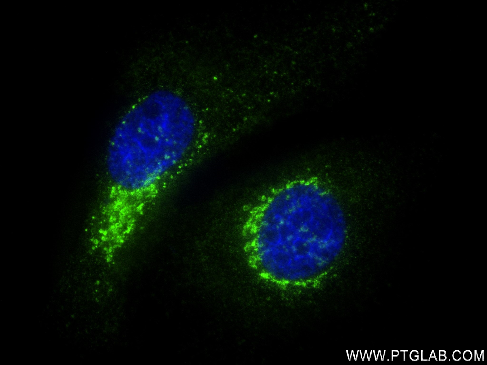 Immunofluorescence (IF) / fluorescent staining of HeLa cells using TGOLN2,TGN46 Recombinant antibody (83099-2-RR)