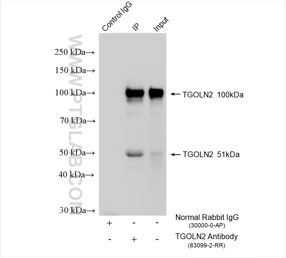 Immunoprecipitation (IP) experiment of HeLa cells using TGOLN2,TGN46 Recombinant antibody (83099-2-RR)