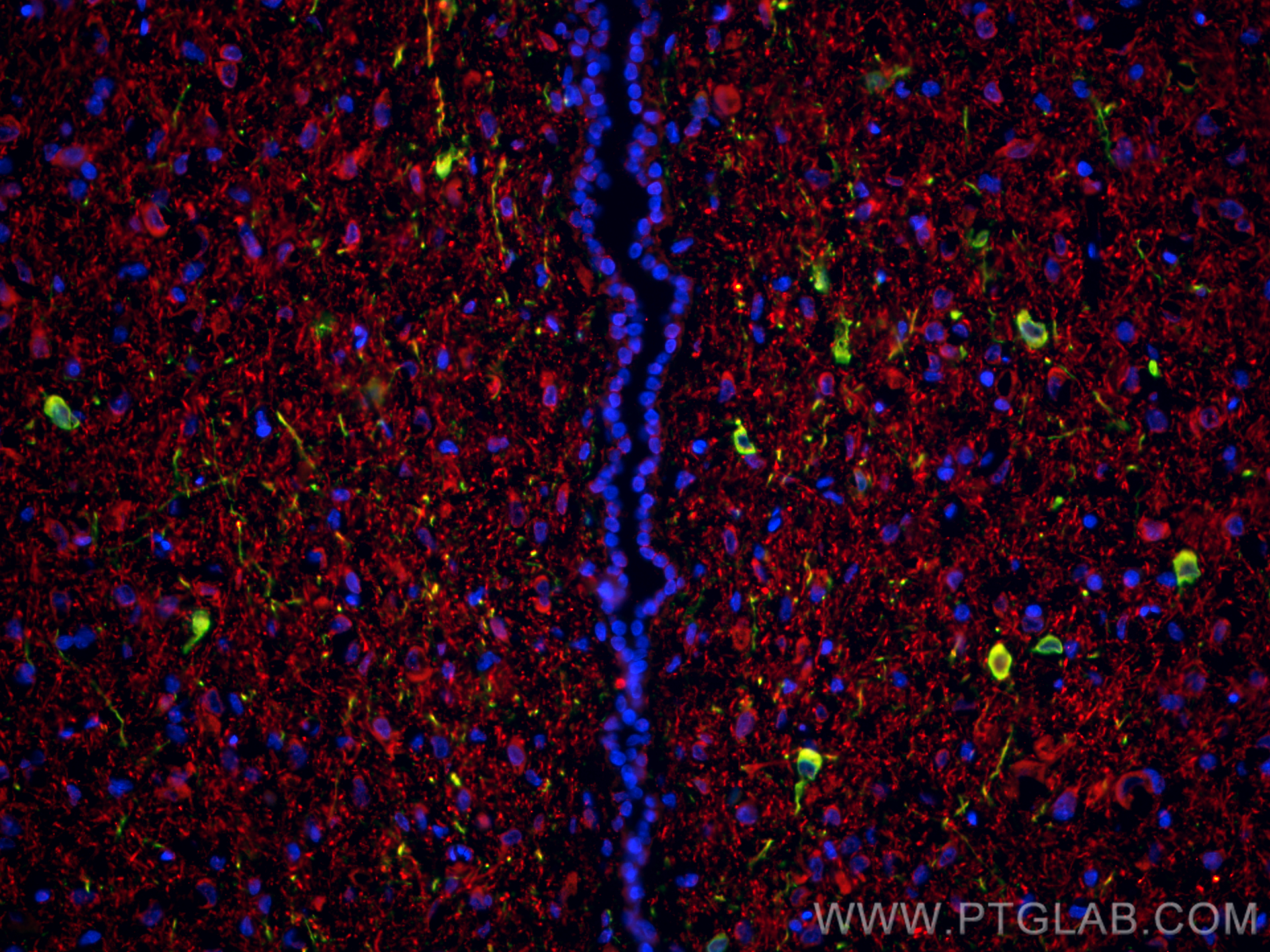 Immunofluorescence (IF) / fluorescent staining of rat brain tissue using TH Polyclonal antibody (25859-1-AP)