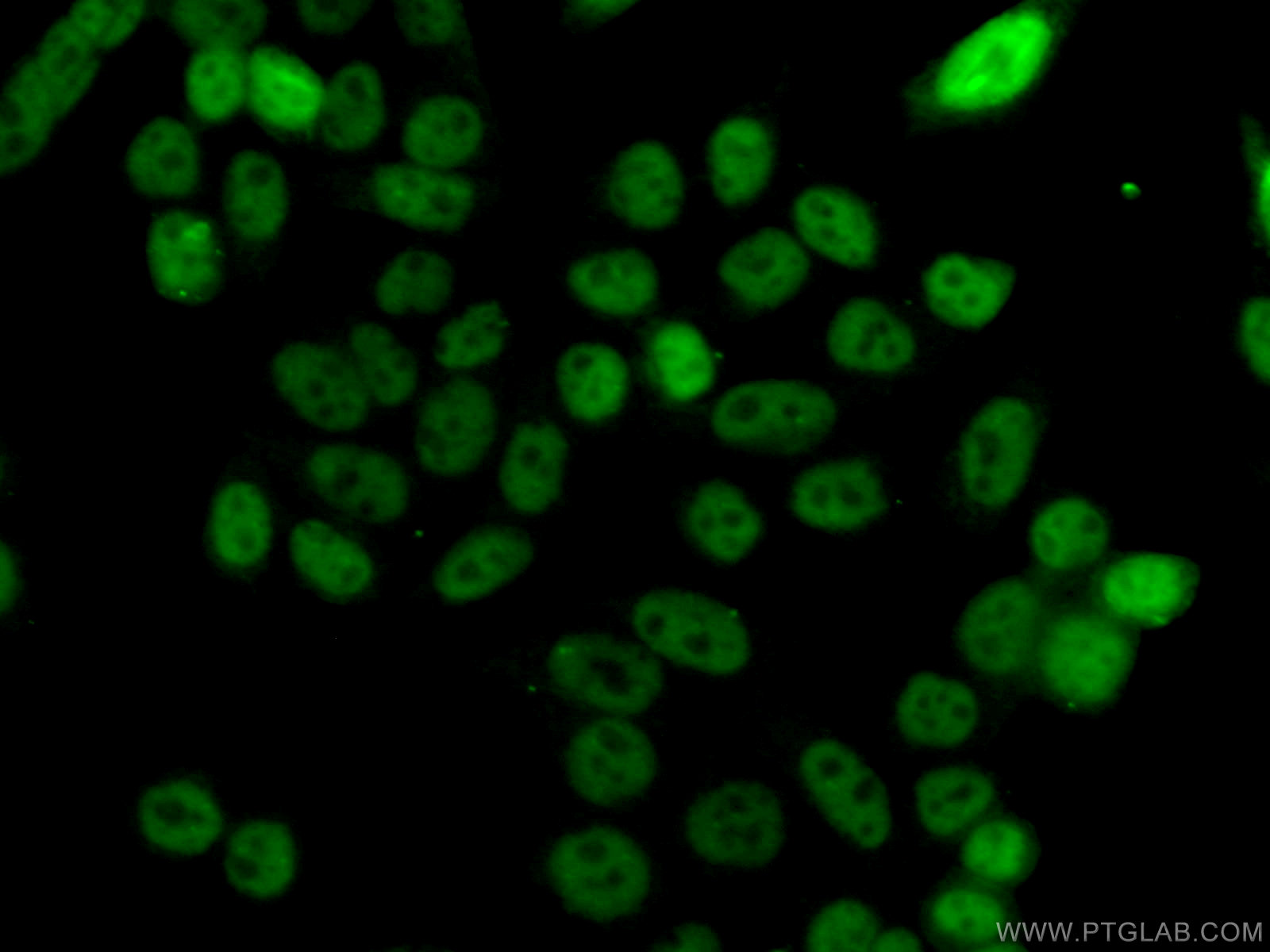 Immunofluorescence (IF) / fluorescent staining of HeLa cells using TH1L Polyclonal antibody (28417-1-AP)