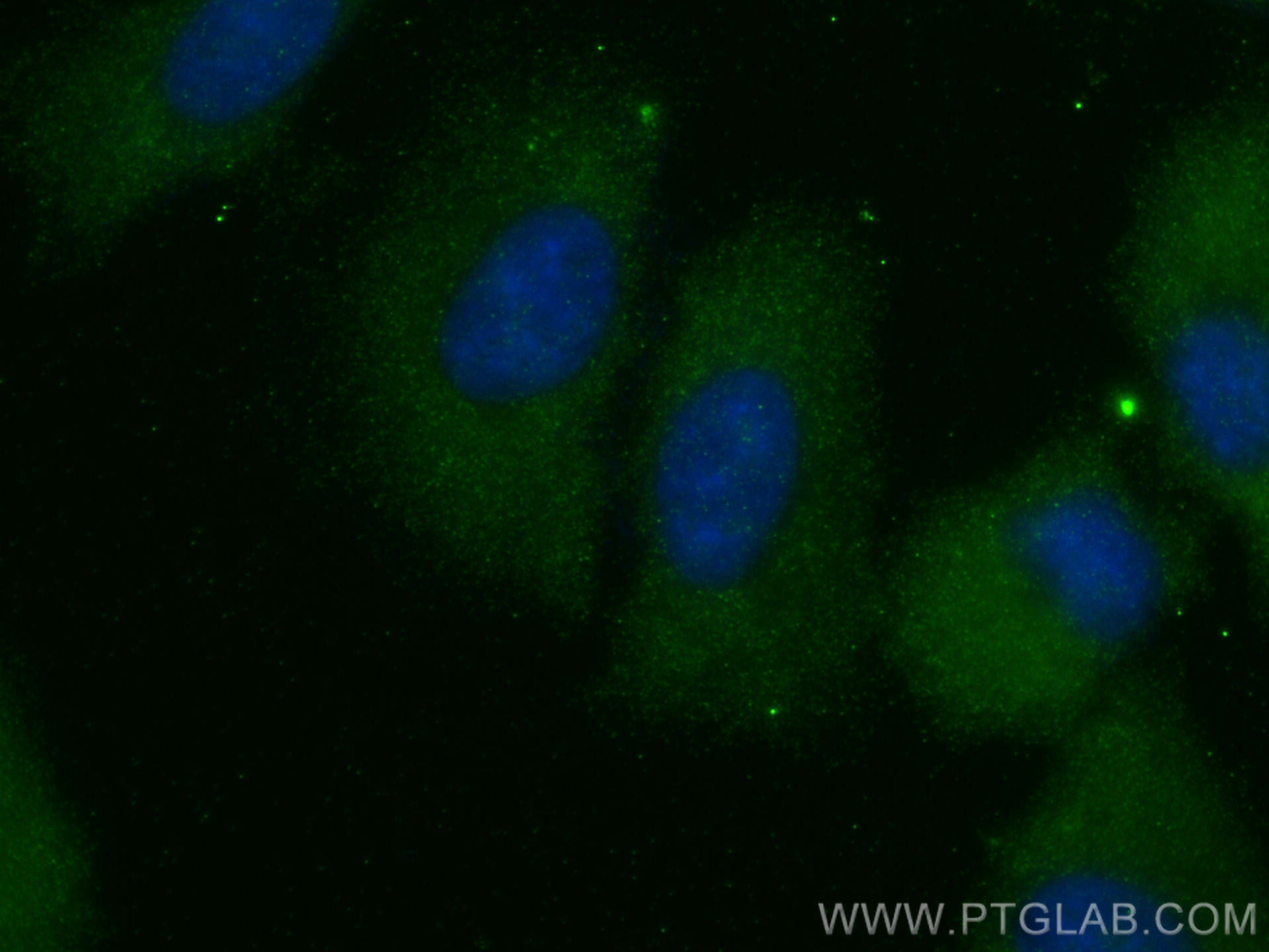 Immunofluorescence (IF) / fluorescent staining of A549 cells using THADA Polyclonal antibody (12909-1-AP)