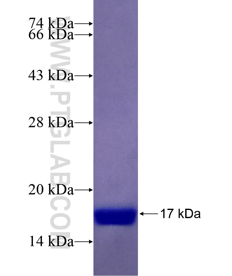 THBS2 fusion protein Ag25750 SDS-PAGE