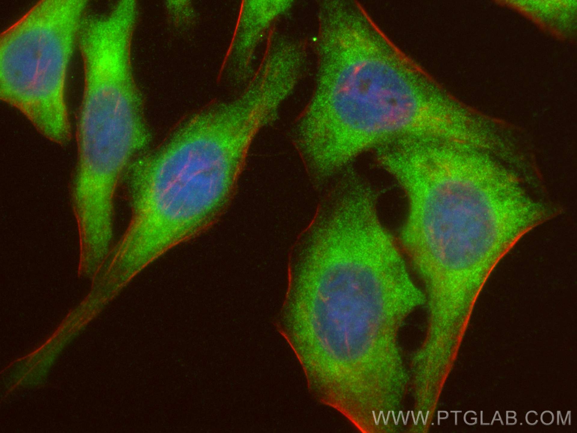 Immunofluorescence (IF) / fluorescent staining of HepG2 cells using THEM2 Polyclonal antibody (16782-1-AP)