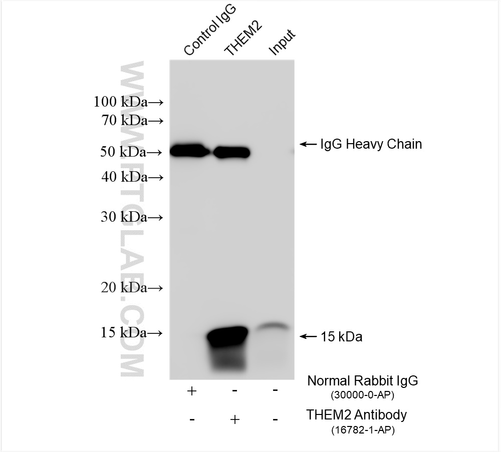 Immunoprecipitation (IP) experiment of HeLa cells using THEM2 Polyclonal antibody (16782-1-AP)