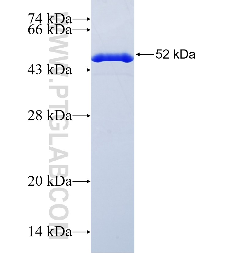 THEM5 fusion protein Ag21654 SDS-PAGE