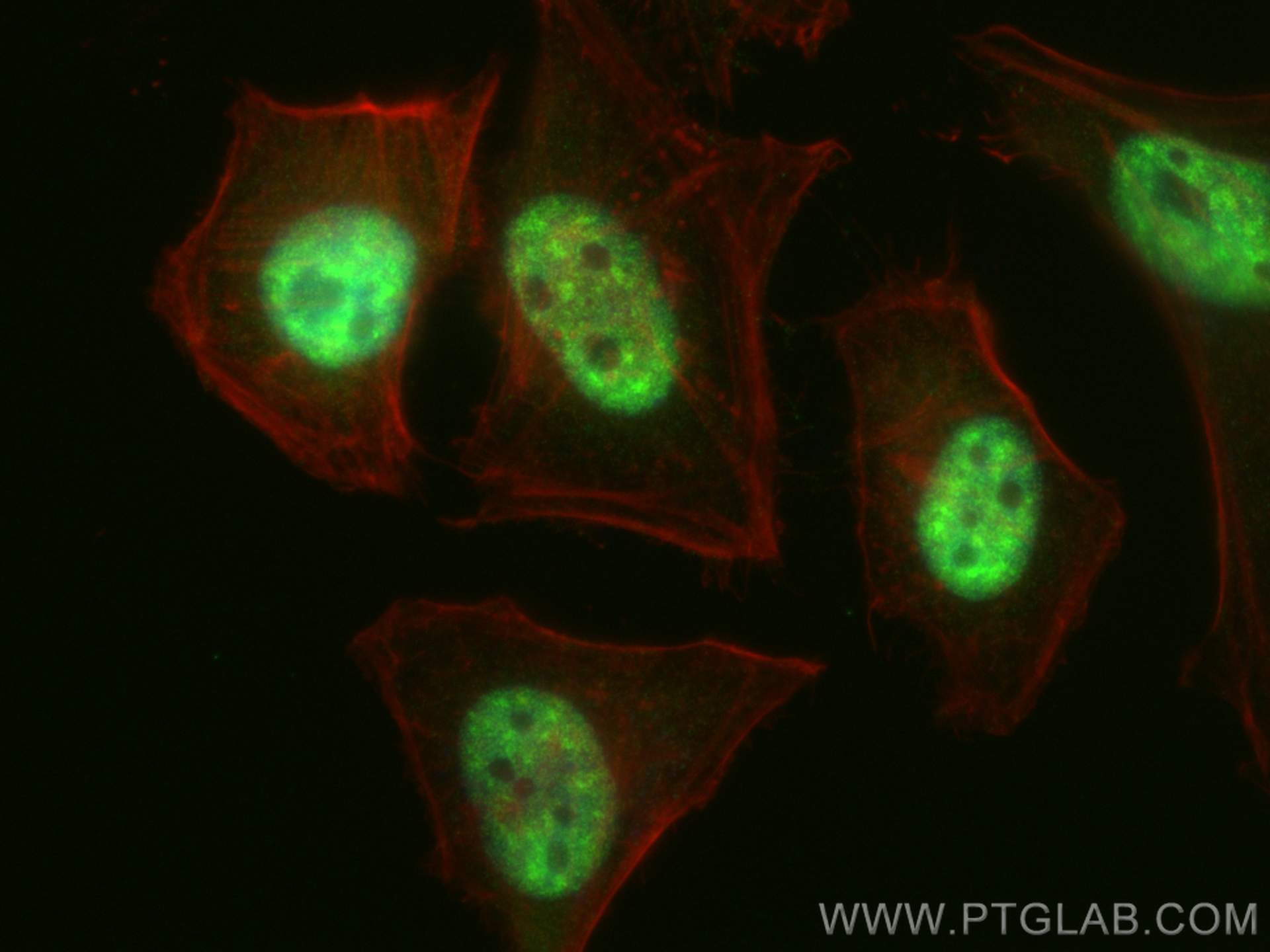 Immunofluorescence (IF) / fluorescent staining of HeLa cells using THOC2 Polyclonal antibody (55178-1-AP)