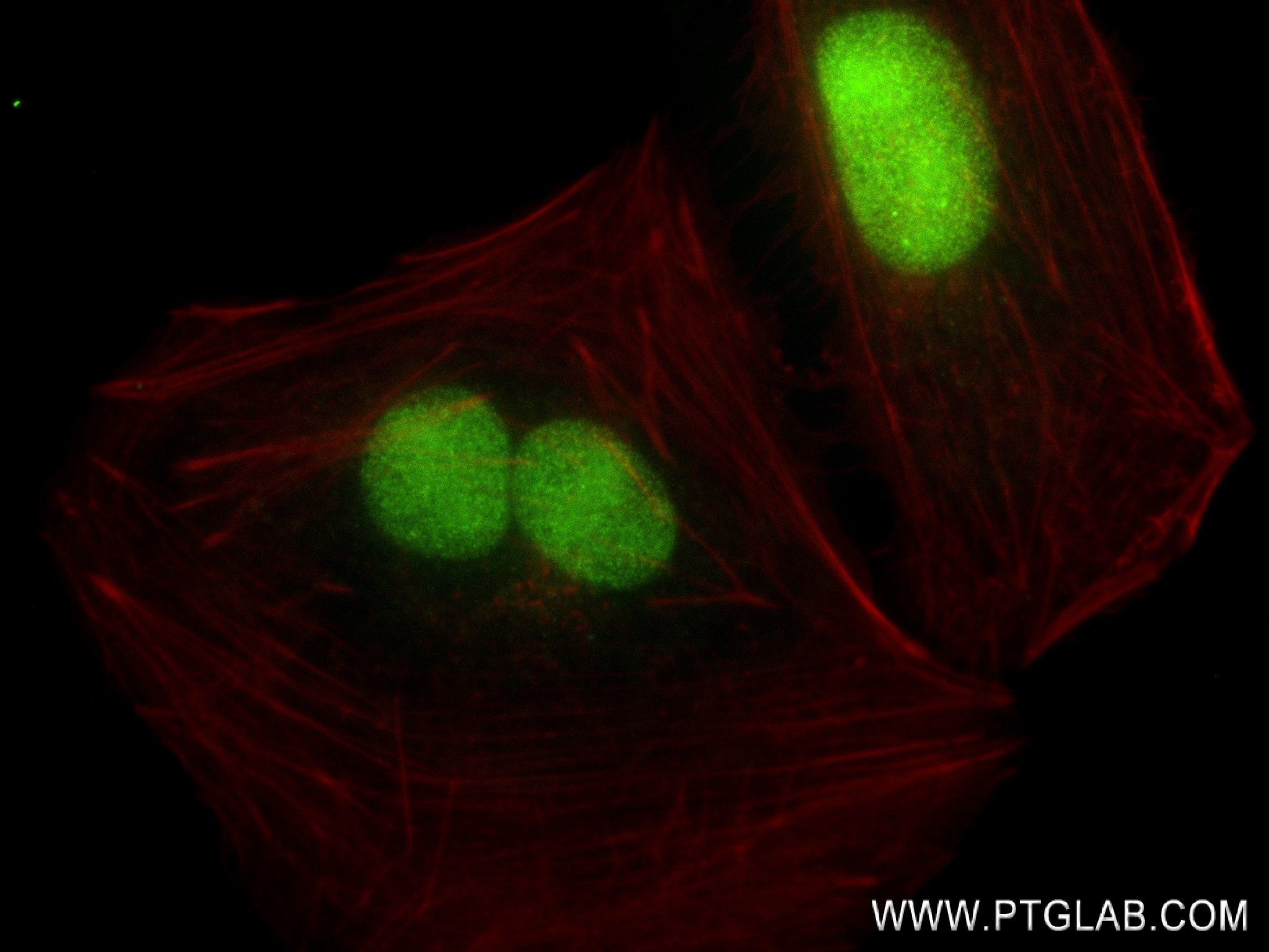 Immunofluorescence (IF) / fluorescent staining of U2OS cells using THOC5 Recombinant antibody (83435-1-RR)