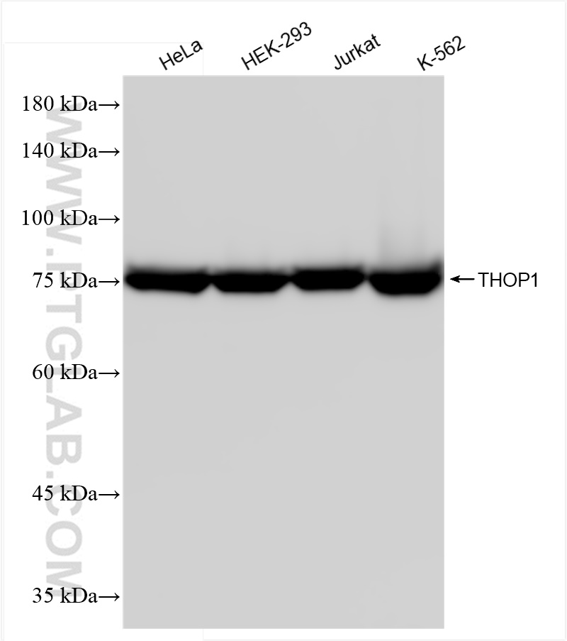 Western Blot (WB) analysis of various lysates using THOP1 Recombinant antibody (84319-3-RR)