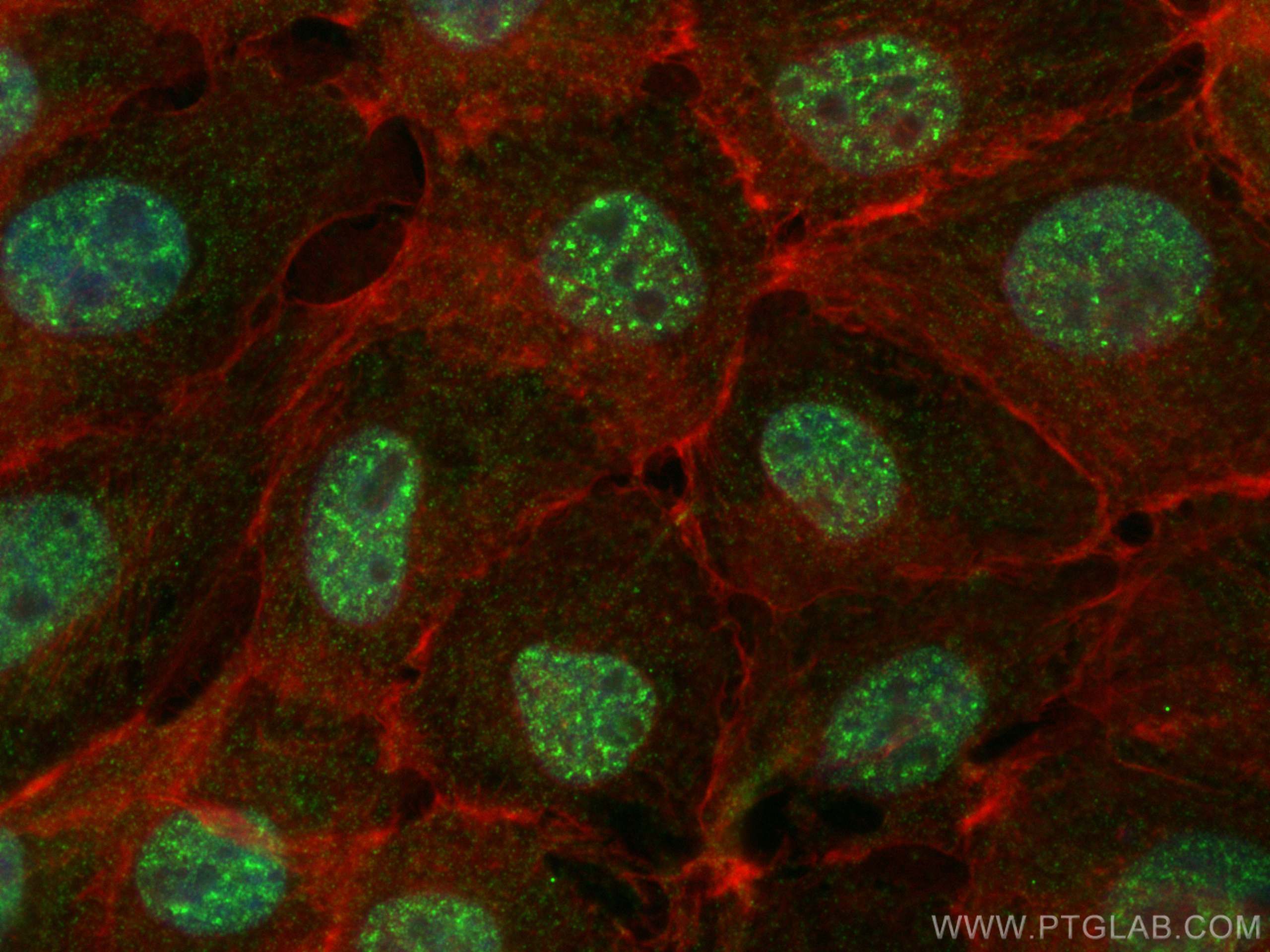 Immunofluorescence (IF) / fluorescent staining of A431 cells using THRA Monoclonal antibody (66703-1-Ig)