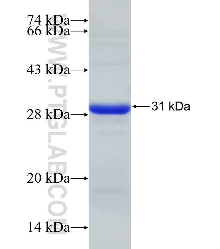 THSD7A fusion protein Ag29107 SDS-PAGE