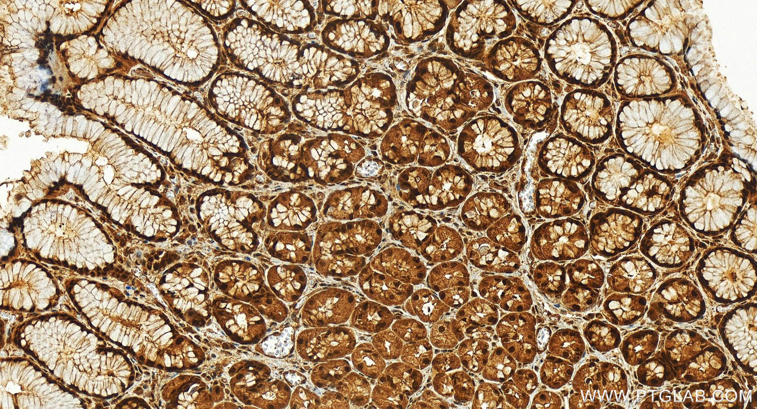 Immunohistochemistry (IHC) staining of human stomach tissue using TIAR Polyclonal antibody (17649-1-AP)