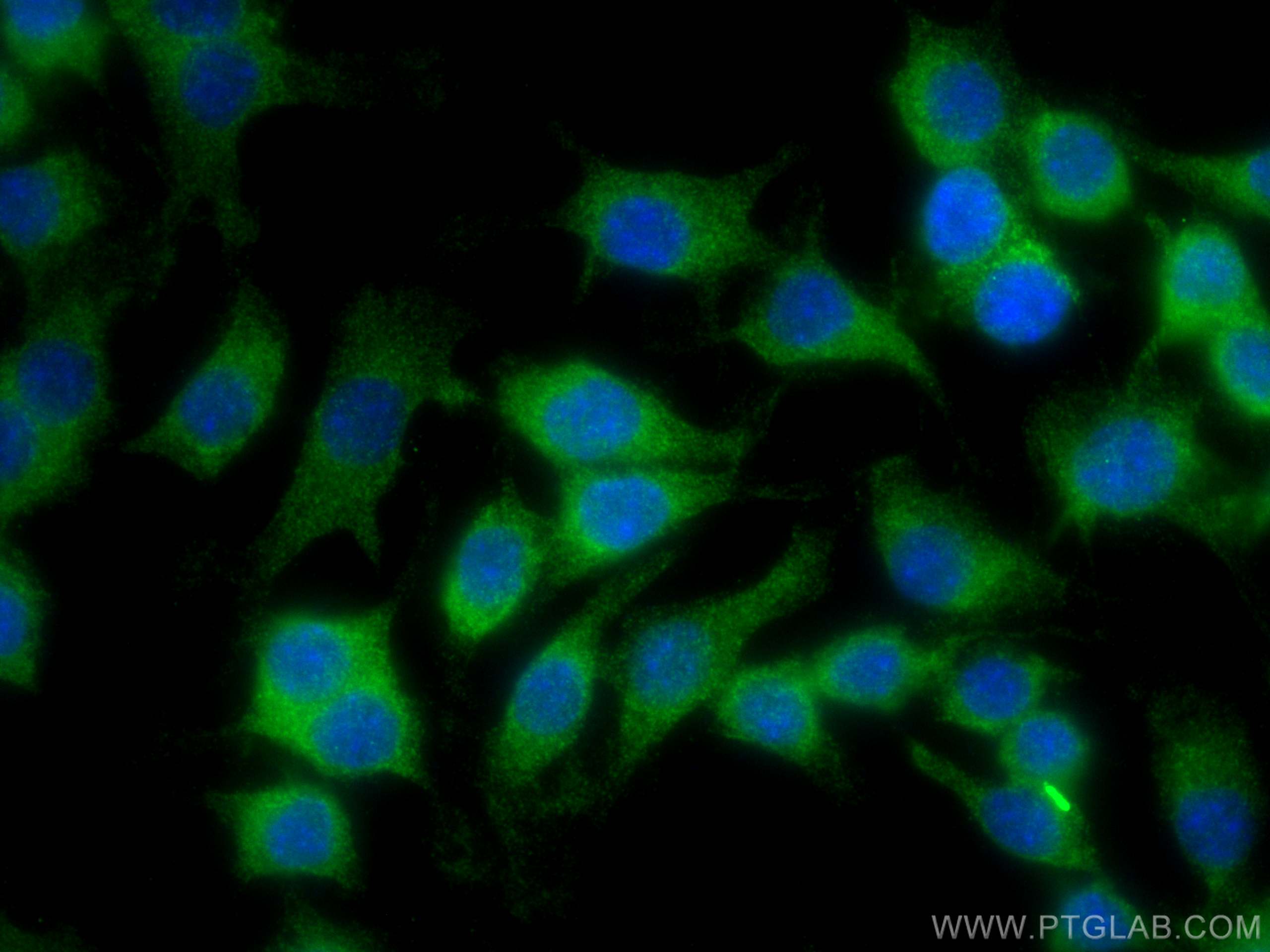 Immunofluorescence (IF) / fluorescent staining of RAW 264.7 cells using TIAM2 Polyclonal antibody (26870-1-AP)