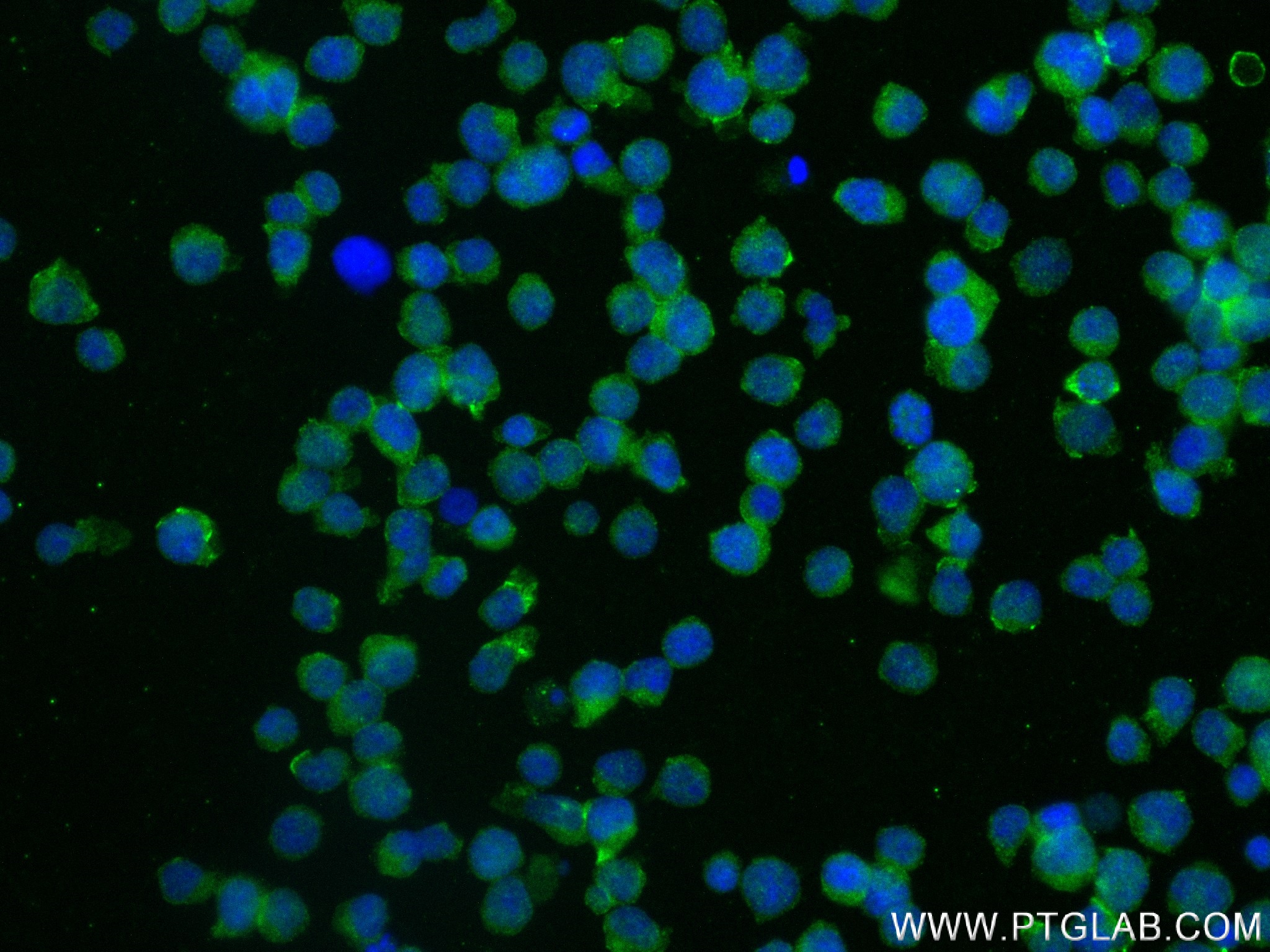 Immunofluorescence (IF) / fluorescent staining of Jurkat cells using TIGIT Recombinant antibody (83545-1-RR)